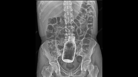 ~New Strain Of Covid!~