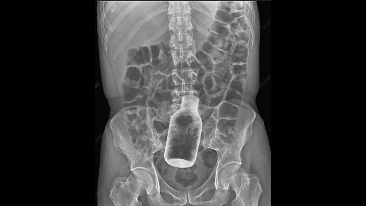 ~New Strain Of Covid!~