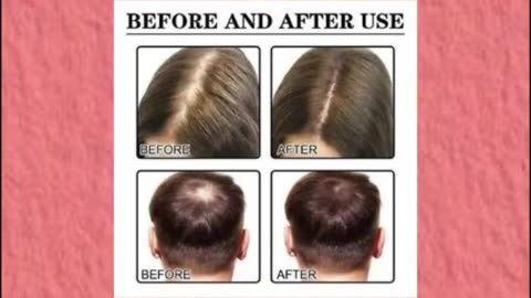 Noor Hair Growth Serum African Olives Grow Hair Fast shop link https://bit.ly/3NcAOEm