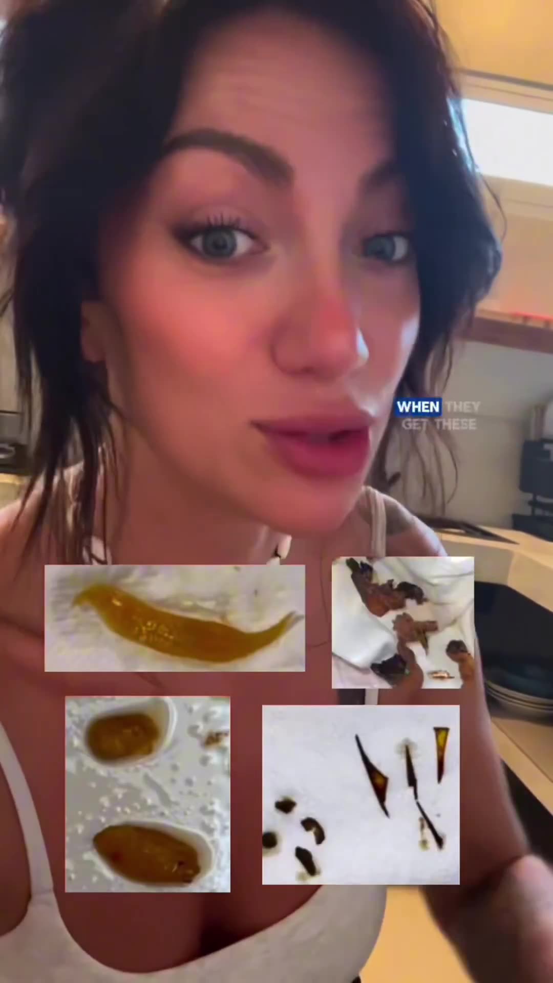 🪱Parasite Reality Check: • The fluke is a common worm found worldwide