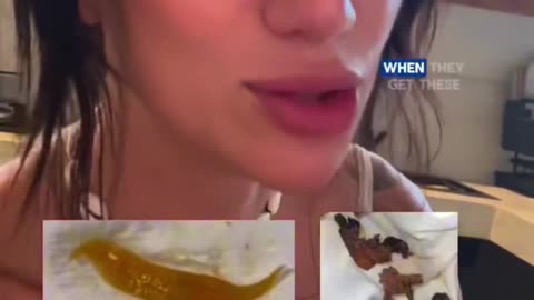 🪱Parasite Reality Check: • The fluke is a common worm found worldwide