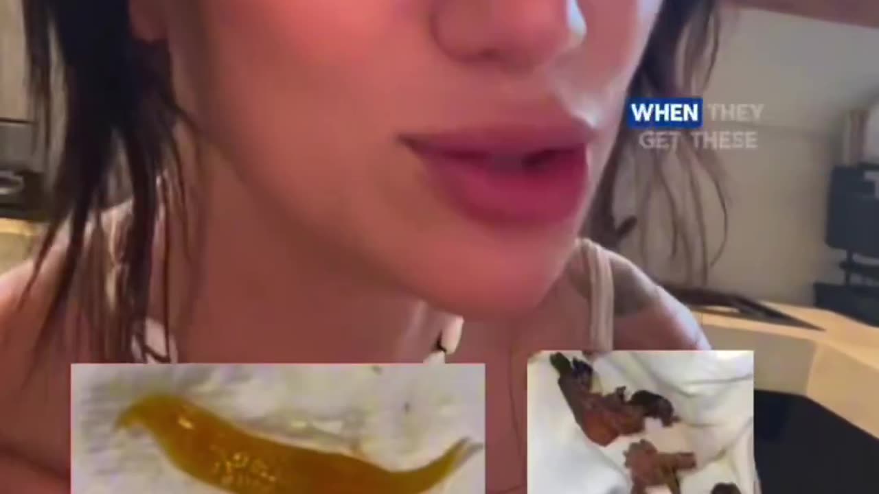 🪱Parasite Reality Check: • The fluke is a common worm found worldwide