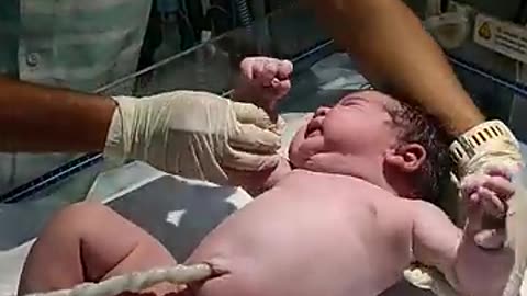 Amazing: newborn baby after birth #crying #motivation #viral vedio #nursing work