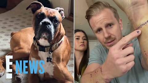 Bachelor_s Sean Lowe Hospitalized Over Violent Attack by His Rescue Dog