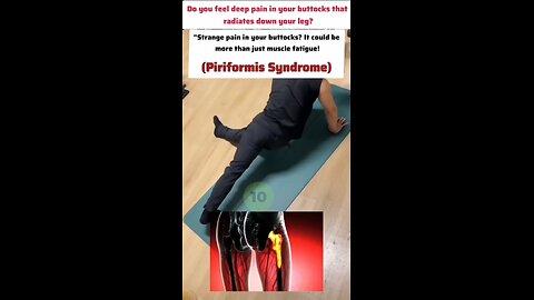 buttock pain
