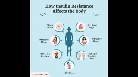 Dr Dhand reveals how to diagnose Insulin Resistance caused and symptoms