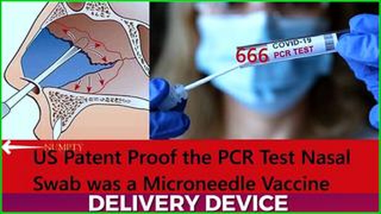 Patent for a Microneedle Nasal Delivery Device, also known as a PCR Nasal Test Swab