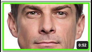 VAXX poison turns actor’s brain to mush – nearly killed by jab-induced TUMOR