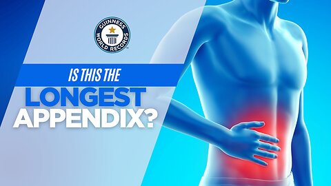 Is this the longest appensix?