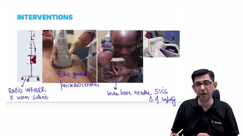 30. Pulseless Electrical Activity