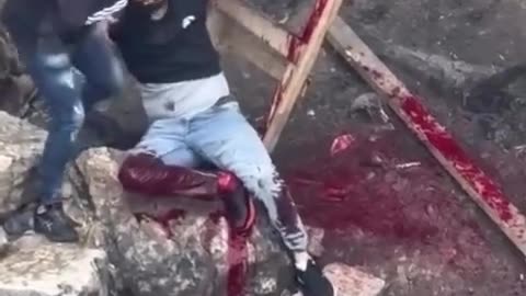 The Red Crescent: Our teams responded to a live-fire gunshot injury