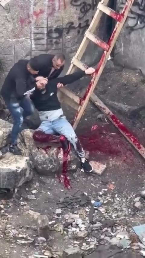 The Red Crescent: Our teams responded to a live-fire gunshot injury