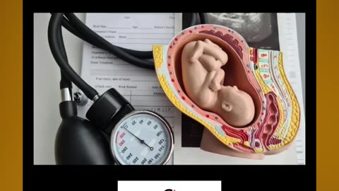 Catholic student ousted from grad program after refusing to observe abortion, lawsuit claims