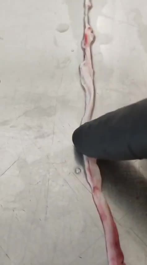 A video made by an Irish embalmer in June. It makes the blood clots hit home.