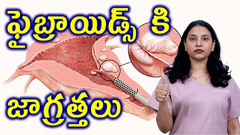 ఫైబ్రాయిడ్స్ కి జాగ్రత్తలు Precautions for Fibroids Removal Surgery Myomectomy Operation Homeopathy