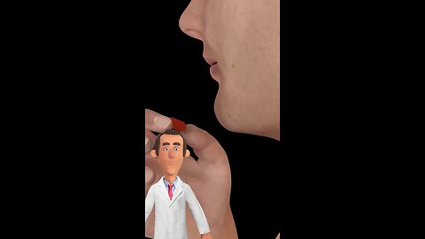 How does steroids works? #doctor #health #steroids