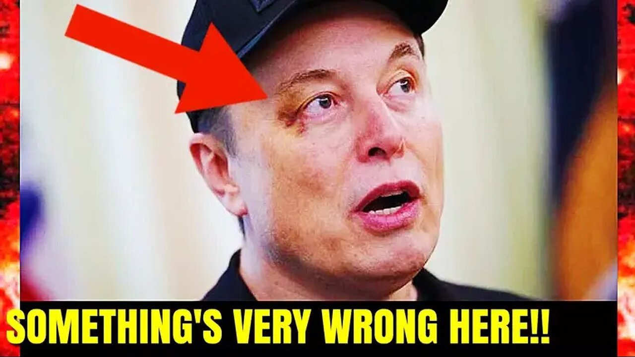 Why Elon Musk Black Eye Disturbs Me - Hours Of Horror