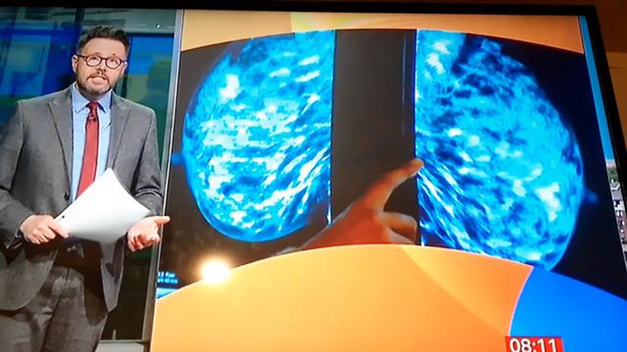 A.I TECHNOLOGY TO TEST FOR BREAST SCREENING