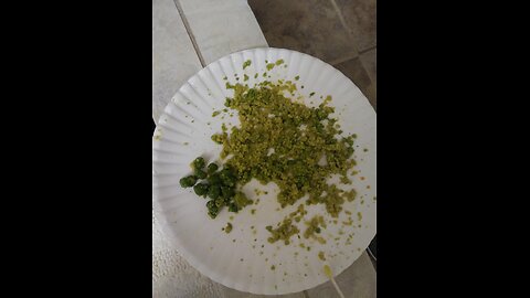 Are those Gallstones? Help for Migraines