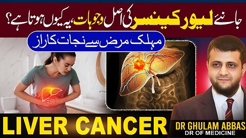 Why liver cancer is Rising Fast ?Causes,Prevention and Natural Protection Tips