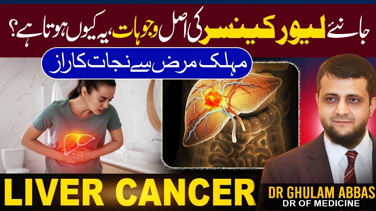 Why liver cancer is Rising Fast ?Causes,Prevention and Natural Protection Tips