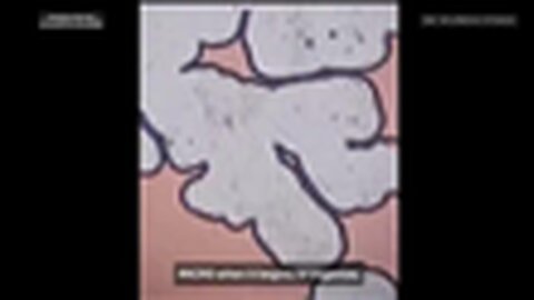 "Exploring the Journey: 10-Year-Old Male Receives Double Moderna Doses and 2 PCR Tests"