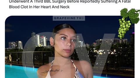 Lina Bina, 24, AKA MissJohnDough, Dies After Reported Third BBL Surgery, From Fatal Blood Clot