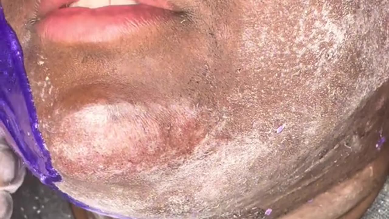 Full Face Waxing with Sexy Smooth Hypnotic Purple Seduction Hard Wax | @fountainofskn