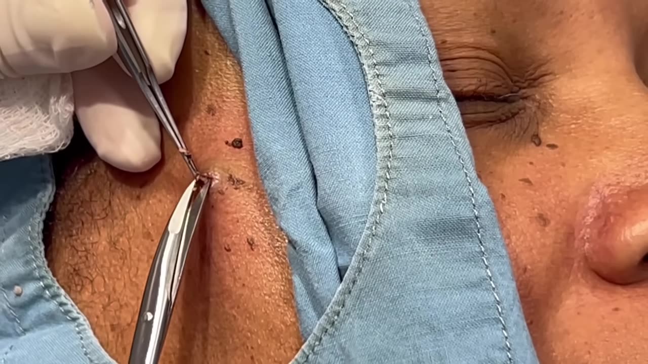 A Couple Of Pops