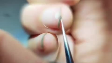 The fingernail dirt under the microscope