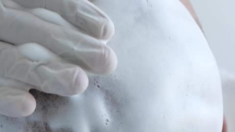 I am coming from Algeria, have done my hair transplant with 5600 grafts.