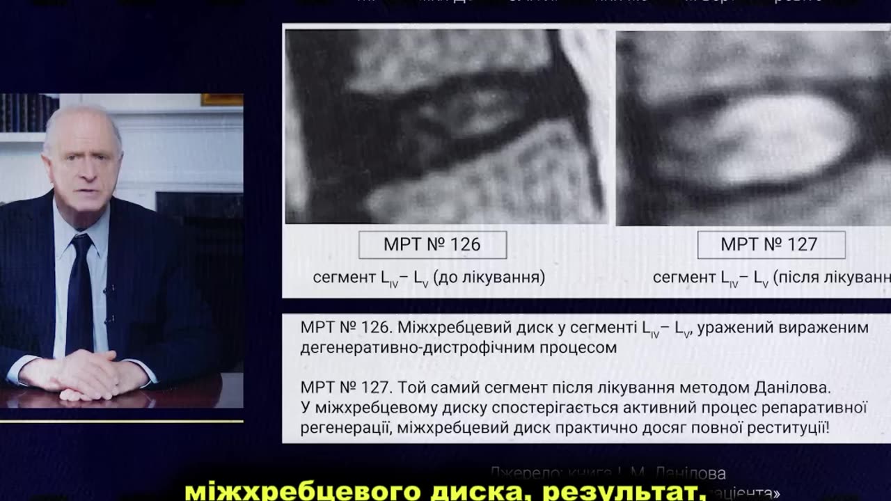 Вас обманювали все життя: міжхребцевий диск МОЖНА відновити!