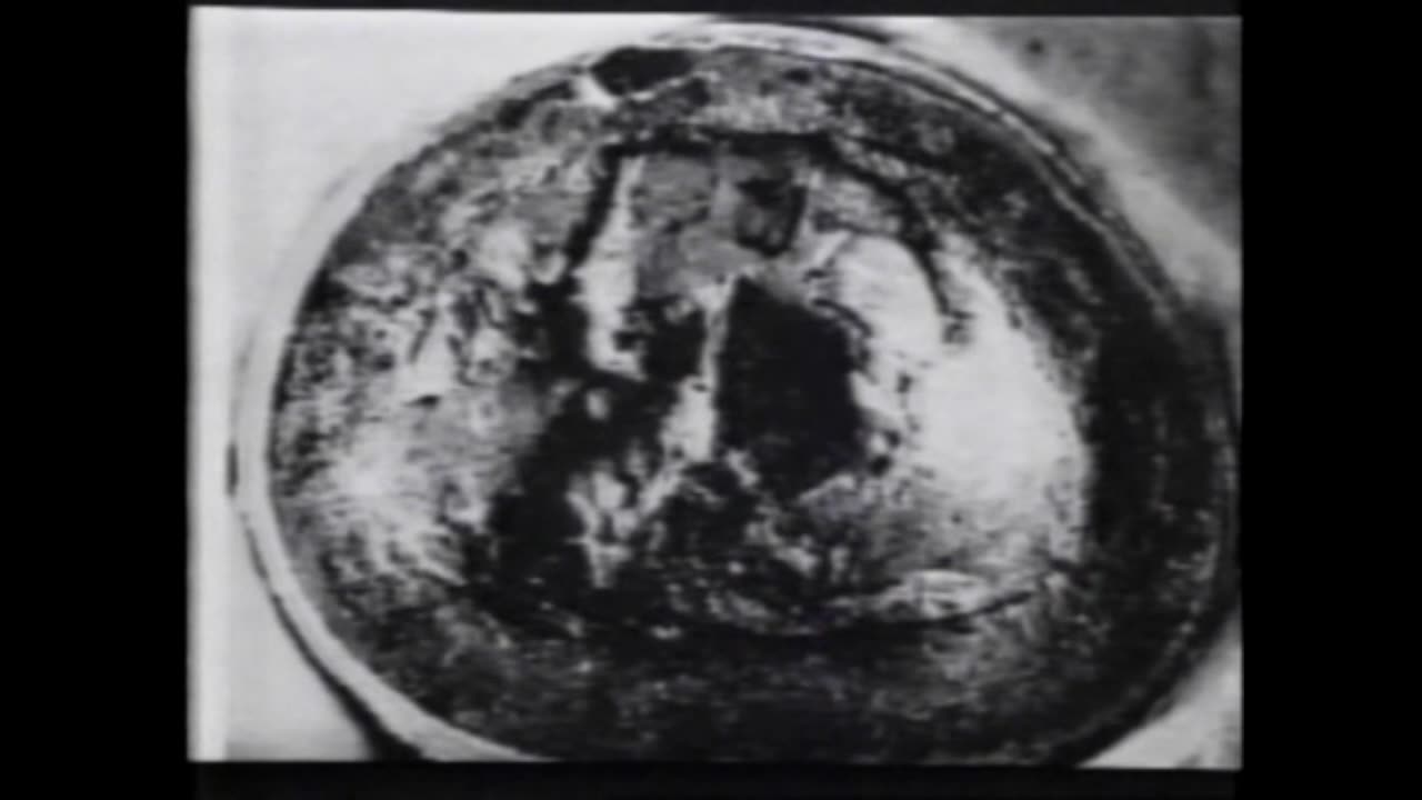 JFK - The Case For Conspiracy Part 1 (1993)