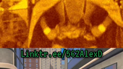 Unmasking the Truth: Otis and El Grande’s Injury Cover-Up!