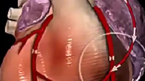 This Is How Coronary Artery Bypass Surgery Restores Blood Flow to the Heart!