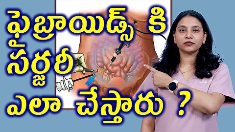 ఫైబ్రాయిడ్స్ కి సర్జరీ ఎలా చేస్తారు? What is Myomectemy Surgery For Fibroids Removal Operation Homeo