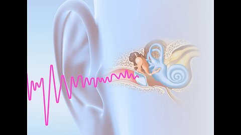 Hidden cause of your tinnitus revealed