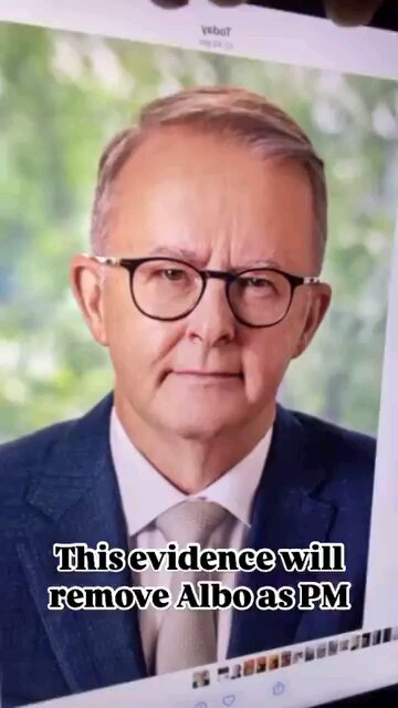 Anthony Albaneses Infected Blood Scandal-Can It Bring Him Down ?