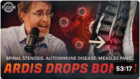 Spinal Stenosis? Autoimmune Disease? Measles Panic? | Dr. 'Bryan Ardis' Drops BOMBS!