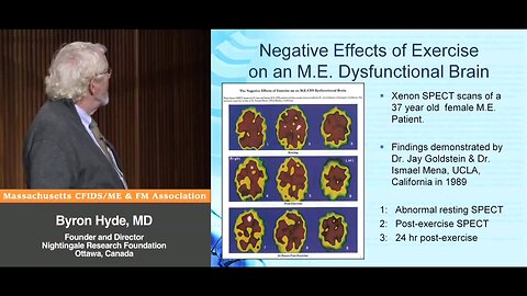 Xenon SPECT Scans & Negative Effects of Exercise on an M.E. Dysfunctional Brain - Bryon Hyde, MD