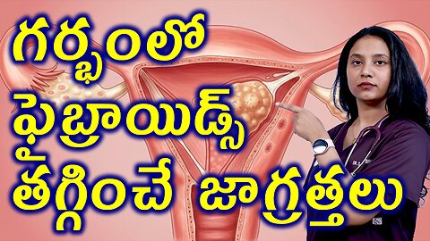 గర్భంలో ఫైబ్రాయిడ్స్ తగ్గించే జాగ్రత్తలు Precautions for Infertility Due to Fibroids Homeopathy Cure