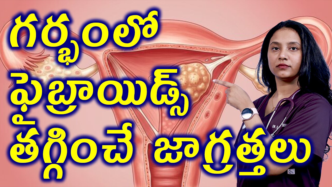 గర్భంలో ఫైబ్రాయిడ్స్ తగ్గించే జాగ్రత్తలు Precautions for Infertility Due to Fibroids Homeopathy Cure