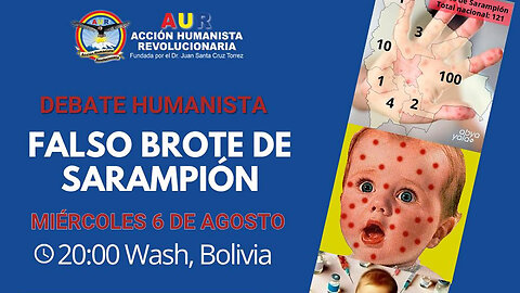 06-08-2025 Falso brote de sarampión: ¿crisis real o manipulación?