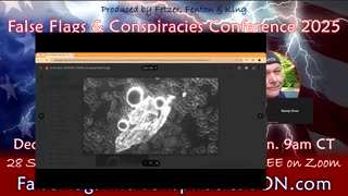 Blood Analysis After mRNA "Vaccinations" - Danny Cirrus