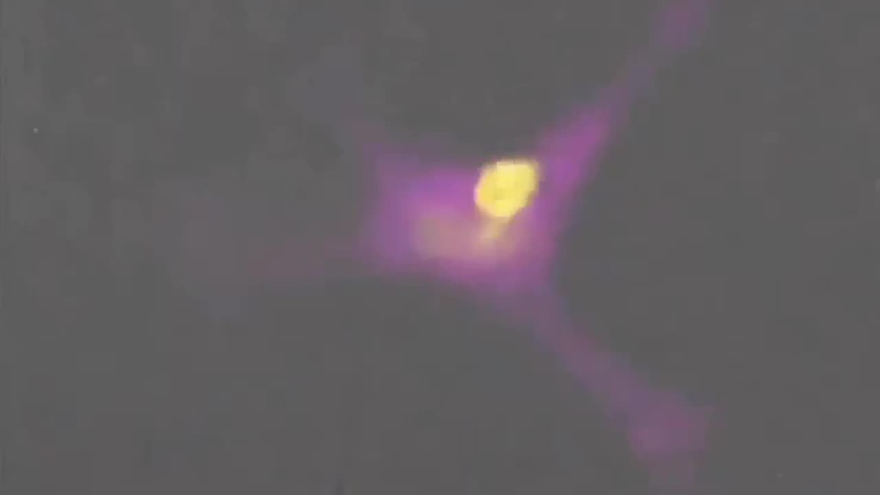 T-Cell destroys a cancer cell.