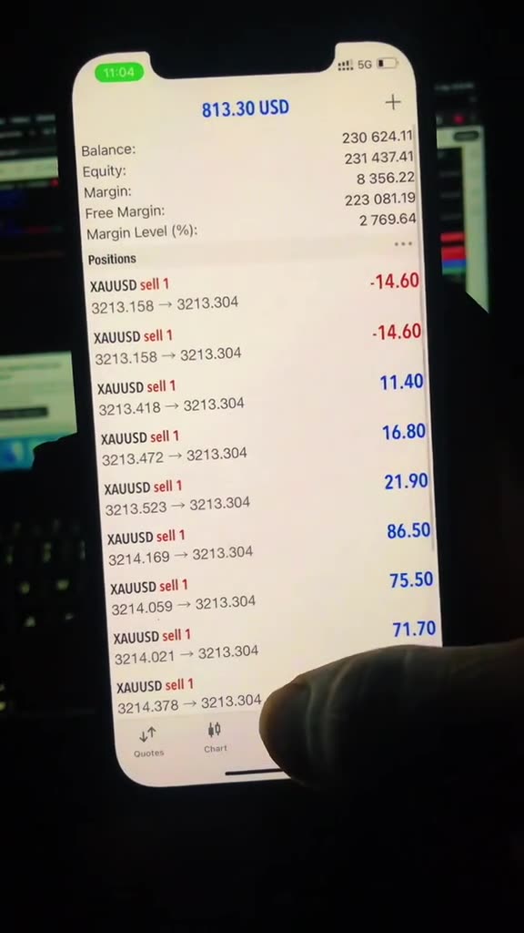 +$10000 Profit in Gold Trading Within 5 Minutes 💰🤯 Live Gold Trading