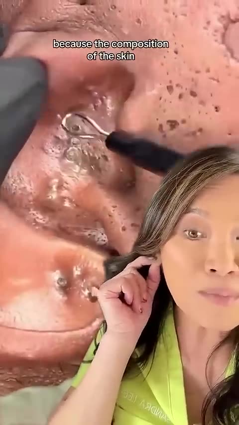 Matching Ear Skin minkology101skincare