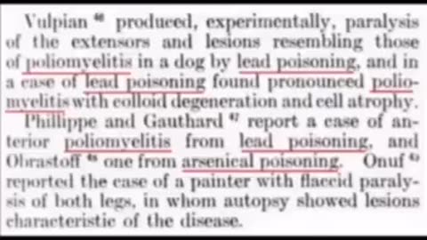 When People think Polio Was Caused By A 'Virus'👇 🧐Pause to Read