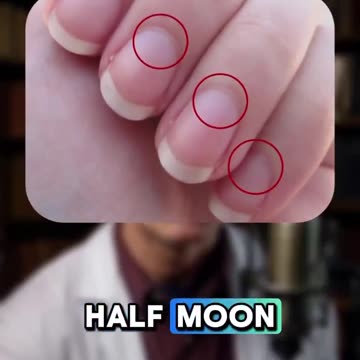 Your Nails Are Telling You Something