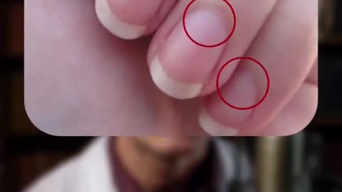 Your Nails Are Telling You Something